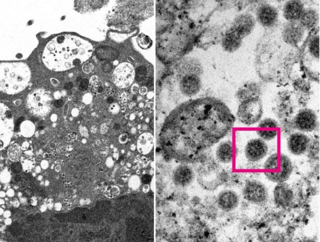 Grimca të vogla virale të zeza/ Zbulohen pamjet e variantit të ri në mikroskop