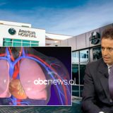 Embolia pulmonare, Dr. Alfred Nona: Një nga shkaktarët kryesor të vdekjeve, lidhja me Covid-19