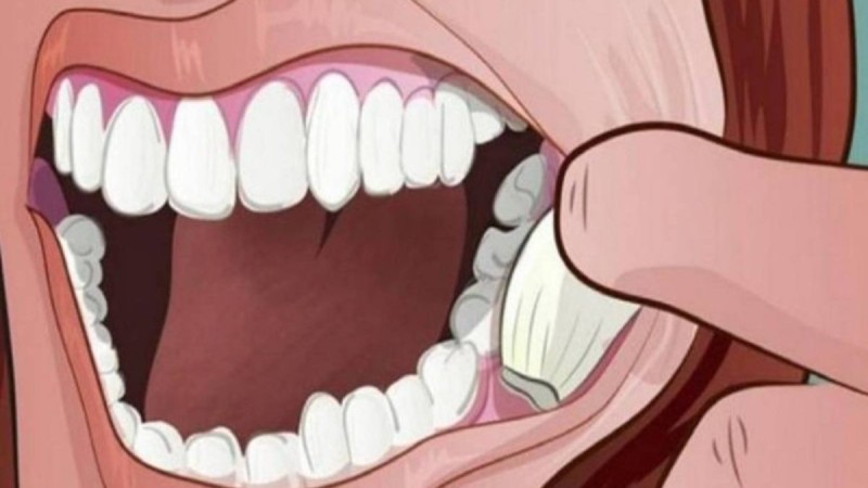 Keni dhimbje dhëmbi? Vendosi një thelpi hudhër në gojë dhe rezultati është i mrekullueshëm