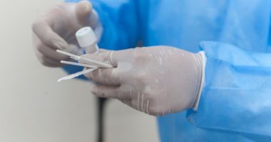 Maqedonia e Veriut nis fushatën e testimit të rastësishëm