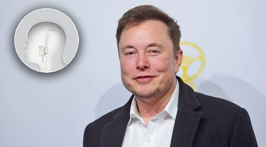 “Chip-i” i Elon Musk do të na ofrojë orgazmë me pult