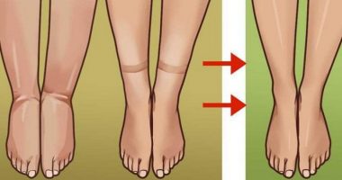 Probleme me qarkullimin e gjakut dhe mbajtjen e lëngjeve? Ushqimet që do t’ju shërojnë