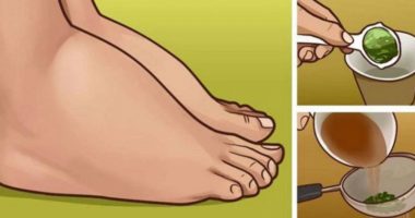 Ilaçi natyral më i fuqishëm për këmbët dhe kyçet e fryra