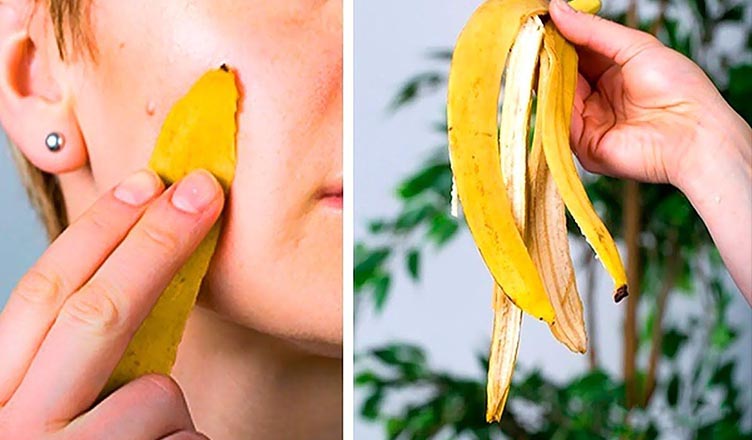 Mos e hidhni lëkurën e bananes, shikoni përfitimet e pabesueshme të saj