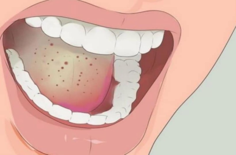 Perimja që eleminon plagët në gojë