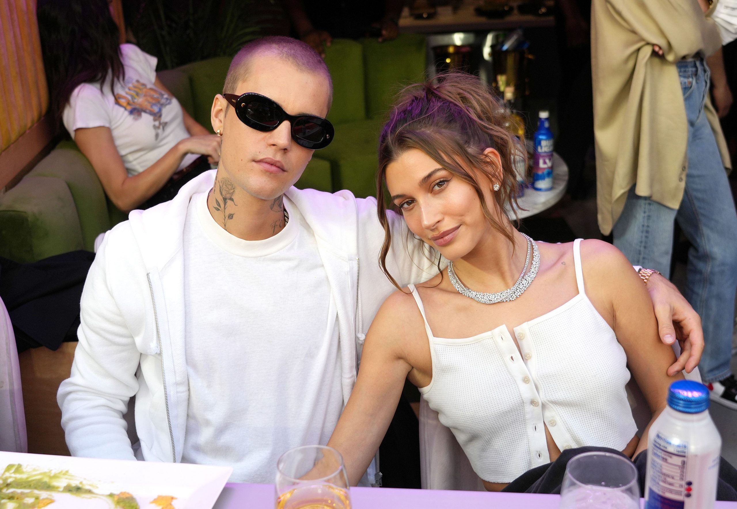 Pësoi paralizë në fytyrë, Hailey Bieber zbulon gjendjen shëndetësore të Justin-it