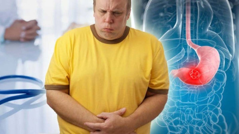 Kanceri i stomakut, simptomat që i ngatërrojmë me sëmundje të tjera