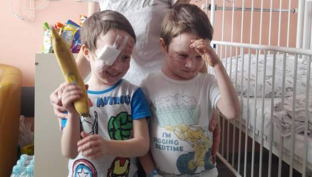 Nëna mbrojti me trup dy djemtë e vegjël nga shpërthimi, mjeku në Poloni i shpëton shikimin familjes ukrainase