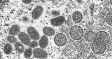 SHBA raporton rastin e parë me sëmundjen afrikane