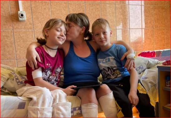 “Kishte njerëz të shtrirë kudo”, historia e trishtë e nënës dhe vajzës 11-vjeçare që humbën këmbët nga sulmi rus