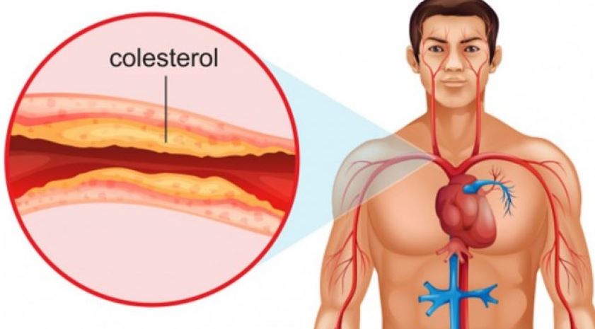 Çfarë është kolesteroli?