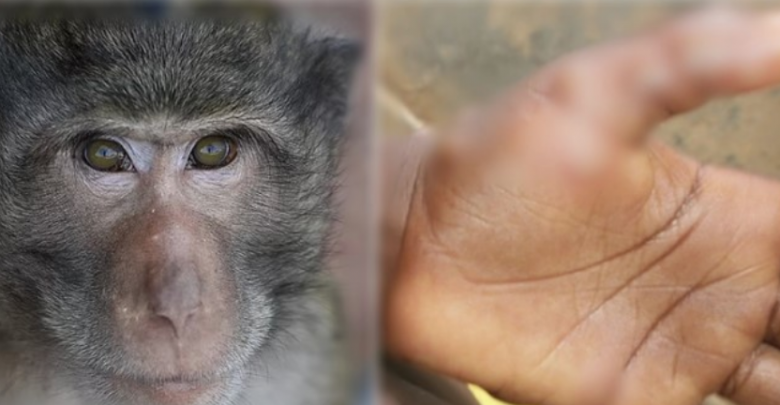 Frikë nga lija e majmunëve, shkon në 3 numri i të infektuarve në Itali, po në Shqipëri