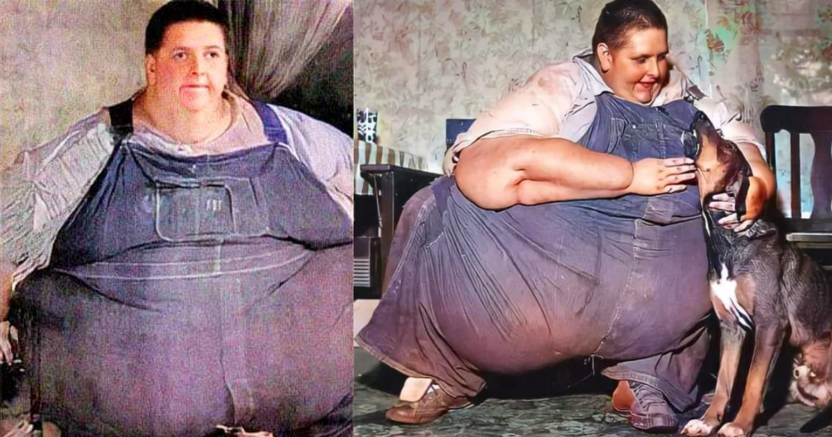 Njeriu më i shëndoshë në botë, 12-vjeç peshonte 132 kg, arriti në 635 dhe vdiq 41-vjeç