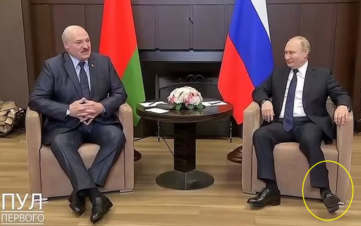 Lëvizjet e çuditshme të këmbëve, “Putini operohet në fshehtësi për të trajtuar kancerin”