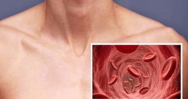 Kini kujdes! Këto shenja paralajmërojnë mpiksjen e gjakut