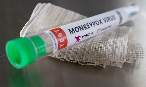 “Është diskriminues”, OBSH kërkon ndryshimin e emrit të virusit të lisë së majmunëve