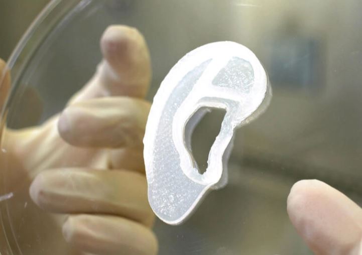 Kirurgët transplantojnë veshin 3D të bërë nga qeliza të gjalla