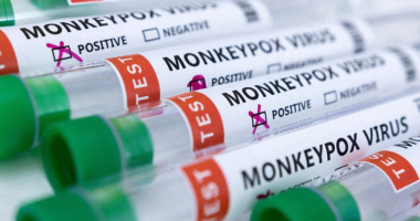 Rusia konfirmon rastin e parë me linë e majmunëve