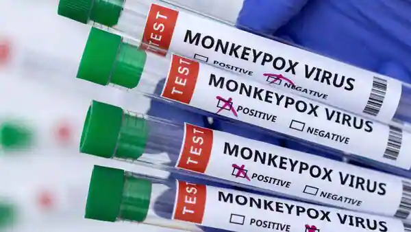 OBSH shpall linë e majmunëve emergjencë shëndetësore globale