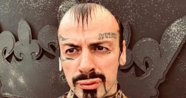 E plagosi partnerja me armë zjarri, publikohet foto e parë e Vali Corleones me fashë në këmbë