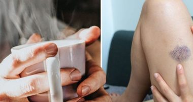 Kujdes! Kjo pije e nxehtë mund t’ju shkaktojë mpiksje gjaku