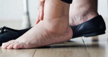 Keni kyçe të ënjtura? Kjo është zgjidhja