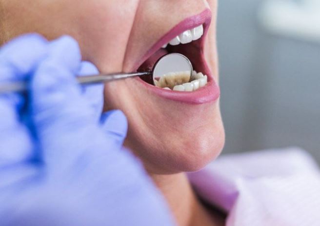 Këto janë zakonet që ju dëmtojnë dhëmbët