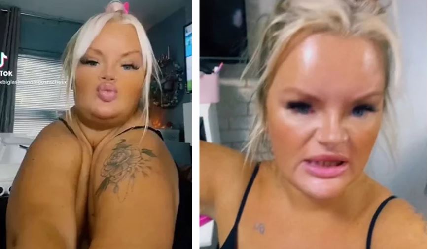 I shokoi të gjithë duke bashkuar supet, gruaja që vuan nga gjendja e rrallë bëhet virale në rrjet