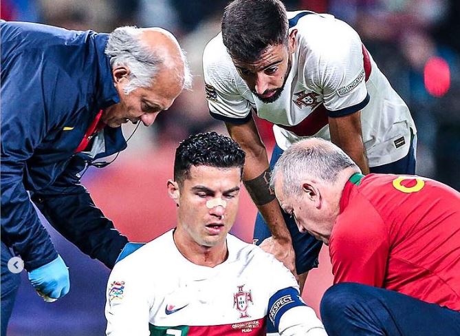 FOTO/ Ronaldo theu hundën në ndeshjen me Çekinë, u përplas me portierin