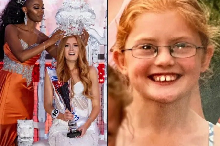 Dikur ishte viktimë e bullizmit, sot ajo është Miss Anglia 2022