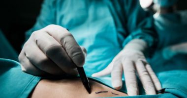 Paralajmërimi i kirurgëve: Në këtë pjesë të trupit nuk duhet të bëni operacione plastike