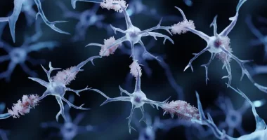 Shkencëtarët zhvillojnë një test gjaku për sëmundjen e Alzheimerit