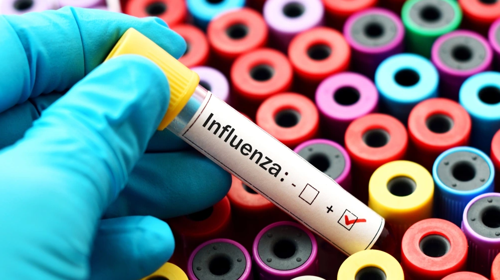 Britania po përballet me epideminë më të keqe të gripit në vitet e fundit