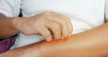 Ju kruhet vazhdimisht lëkura? Kjo është arsyeja