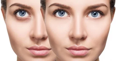 Largojini rrathët e zinj posht syve me një mënyrë natyrale në shtëpi