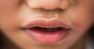 Bima që largon të gjitha viruset brenda 24 orëve