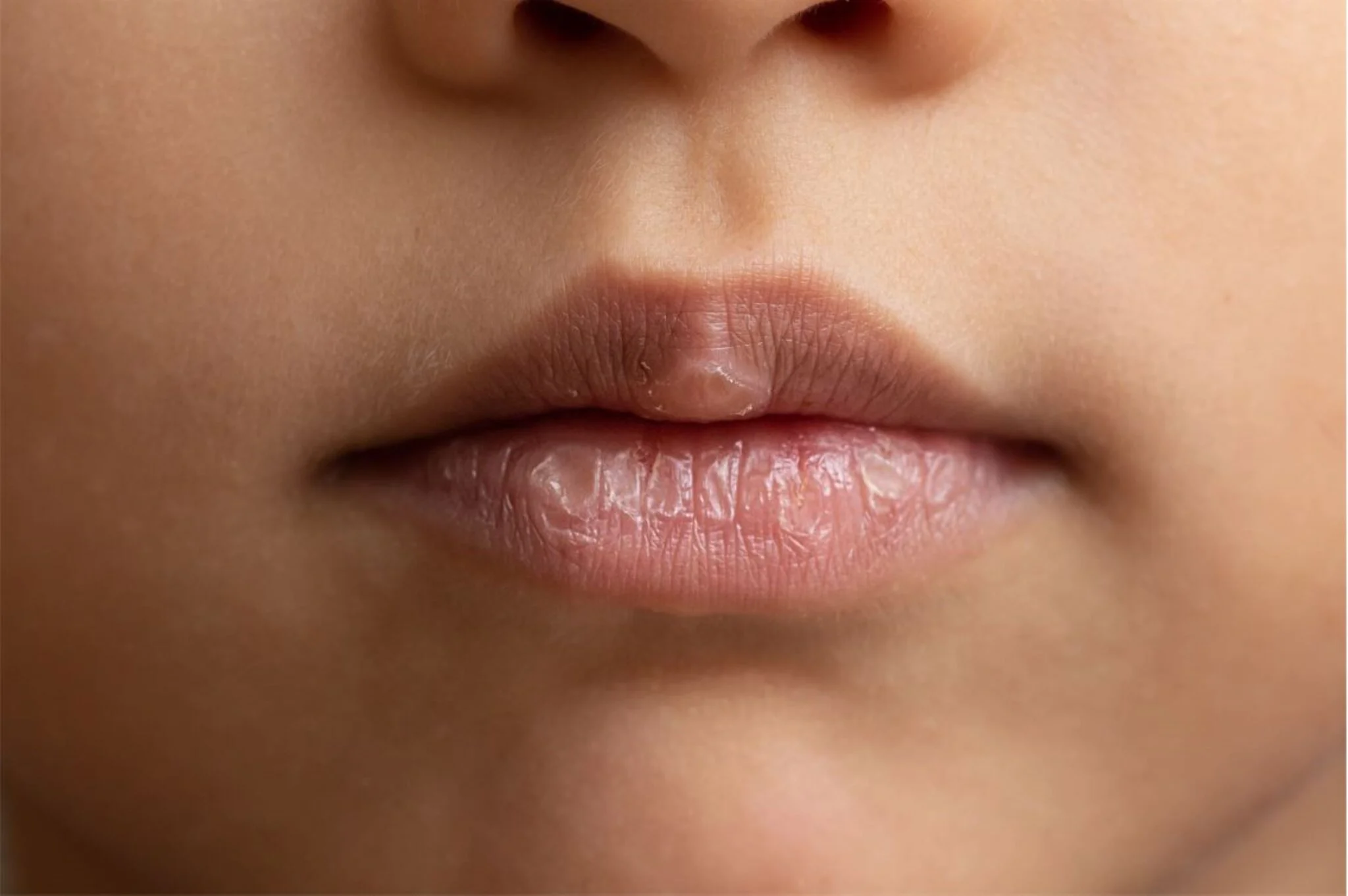 Keni problem me buzët e plasaritura? Këto metodat natyrale do t'ju ndihmojnë