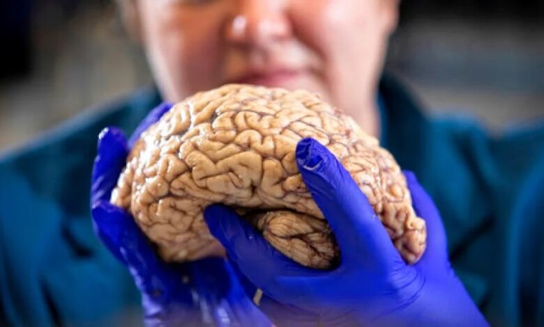 A përdorim vërtet vetëm 10 për qind të trurit?