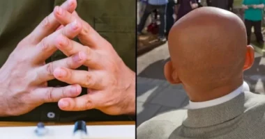 Studimi: Meshkujt mund të zbulojnë përmes gishtave të tyre nëse do të përfundojnë tullac