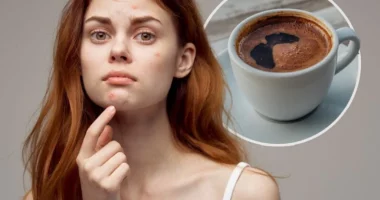 Si ndikon konsumimi i kafesë në lëkurë