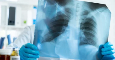 Mjeku tregon dallimin kryesor mes ftohjes së zakonshme dhe inflamacionit të rëndë