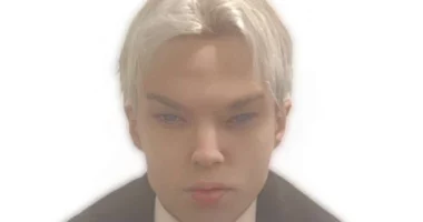 Bëri 12 operacione plastike që t’i ngjante këngëtarit të njohur, ndahet nga jeta 22-vjeçari