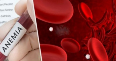 Ushqimet që duhet të hani nëse vuani nga anemia
