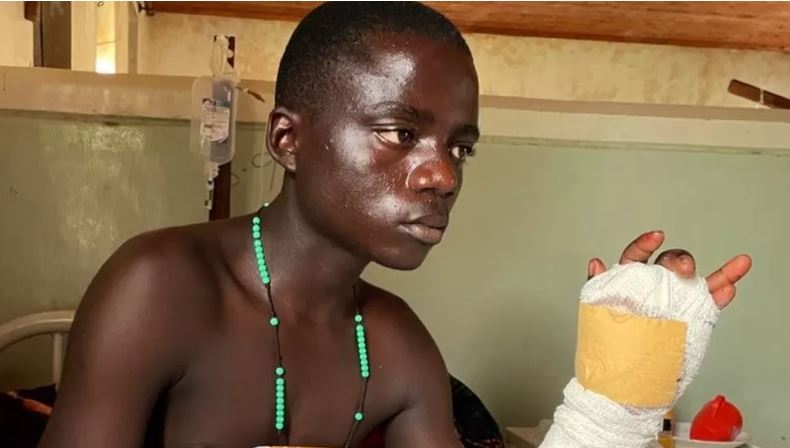 Sulmi terrorist në Ugandë/ I riu tregon tmerrin: Jam lyer me gjakun e shokëve të mi që të mendonin se kam vdekur