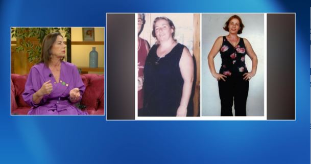 Humbi plot 51 kg, inxhinierja nga Tirana tregon si bëri ndryshimin drastik të trupit të saj