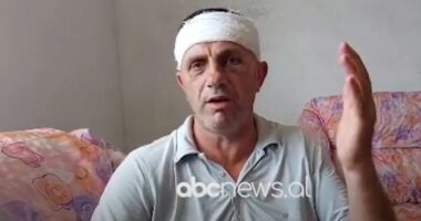 Rrajat i rrahën me shkopinj gome, flet Jashar Maja: I afërmi im është në gjendje shumë të keqe në spital