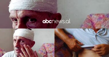 “Më goditën me tyta armësh”, i plagosuri në Borizanë: Kërkoj drejtësi nga shteti, policia erdhi pas 2 orësh