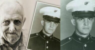 Historia e çuditshme e burrit që vuajti nga lemza për 68 vite