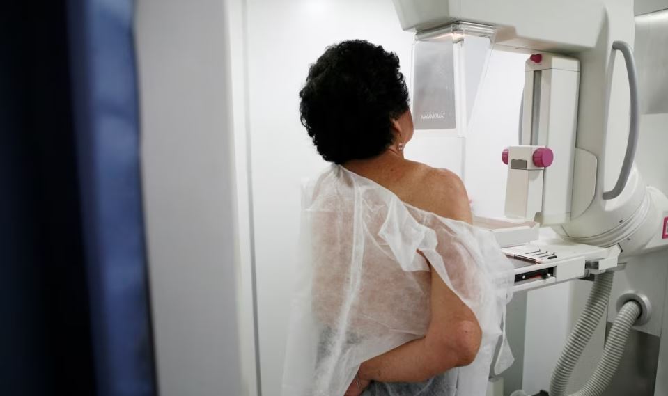 Studimi: Inteligjenca Artificiale ndihmon në zbulimin e kancerit të gjirit