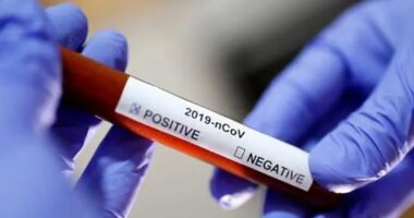 ‘Eris’, varianti i ri i Covid-19 po përhapet në mbarë botën, reagon OBSH